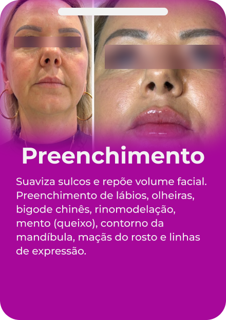 carrossel facial 01