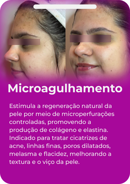 carrossel facial 04
